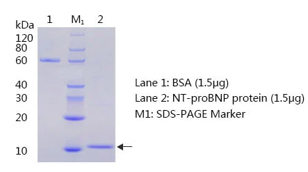 抗人N端脑利钠肽前体抗体-聚丙烯酰胺凝胶电泳和蛋白质印迹法(免疫印迹试验WB)