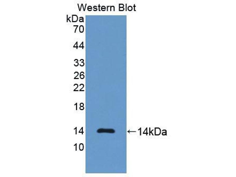 抗人N端脑利钠肽前体抗体-蛋白质印迹法(免疫印迹试验WB)