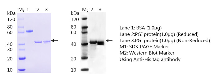 胃蛋白酶原I-蛋白质印迹法(免疫印迹试验WB)