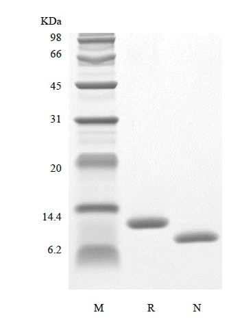 SDS-PAGE of Recombinant Human Interleukin-15