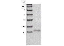 SDS-PAGE of Recombinant Human TNF-related Weak Inducer of Apoptosis Receptor/TNFRSF12A