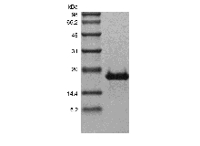 SDS-PAGE of Recombinant Human Transmembrane Activator and CAML Interactor/TNFRSF13B