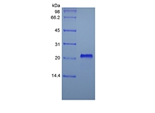 SDS-PAGE of Recombinant Human soluble Tumor Necrosis Factor Receptor Type I/TNFRSF1A