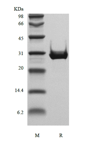 SDS-PAGE of Recombinant Human Insulin-like Growth Factor-Binding Protein 4, Insect Cells Derived