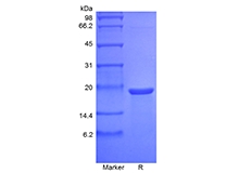 SDS-PAGE of Recombinant Murine Mesencephalic Astrocyte-Derived Neurotrophic Factor