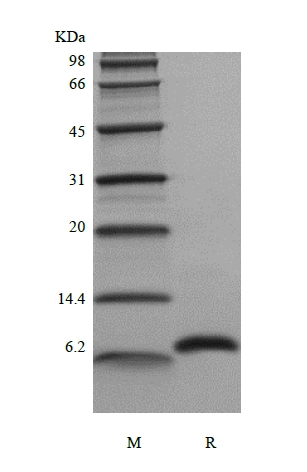 SDS-PAGE of Recombinant Human Hemofiltrate CC Chemokine-1, 66a.a./CCL14