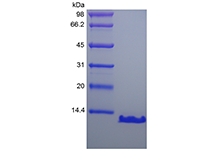 SDS-PAGE of Recombinant Human Parathyroid Hormone 7-84