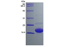 SDS-PAGE of Recombinant Human Cu/Zn Superoxide Dismutase