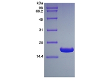 SDS-PAGE of Recombinant Human Ubiquitin-conjugating Enzyme E2 B, His