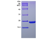 SDS-PAGE of Recombinant Human Ubiquitin-conjugating Enzyme E2 I, His