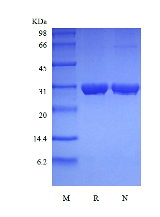 SDS-PAGE of Recombinant Human Ubiquitin-conjugating Enzyme E2 R1