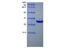 SDS-PAGE of Recombinant Human B-cell Lymphoma-extra Large