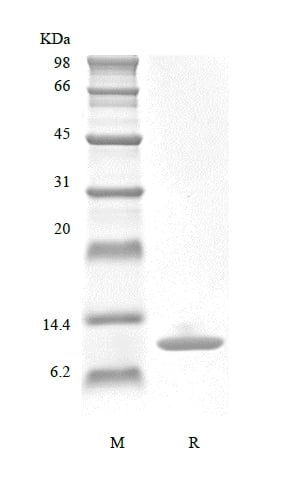 SDS-PAGE of Recombinant Murine Migration Inhibitor Factor