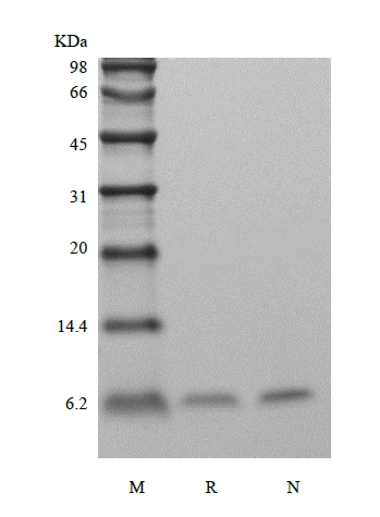 SDS-PAGE of Recombinant HBV Surface Antigen-preS2