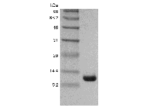 SDS-PAGE of Recombinant Cholera Toxin B subunit