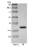 SDS-PAGE of Recombinant Human Tumor Necrosis Factor-alpha/TNFSF2 GMP